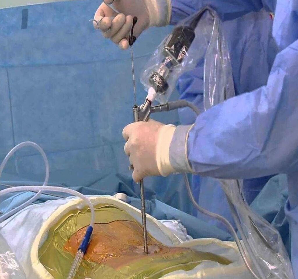 مناظير المخ و الأعصاب و العمود الفقرى