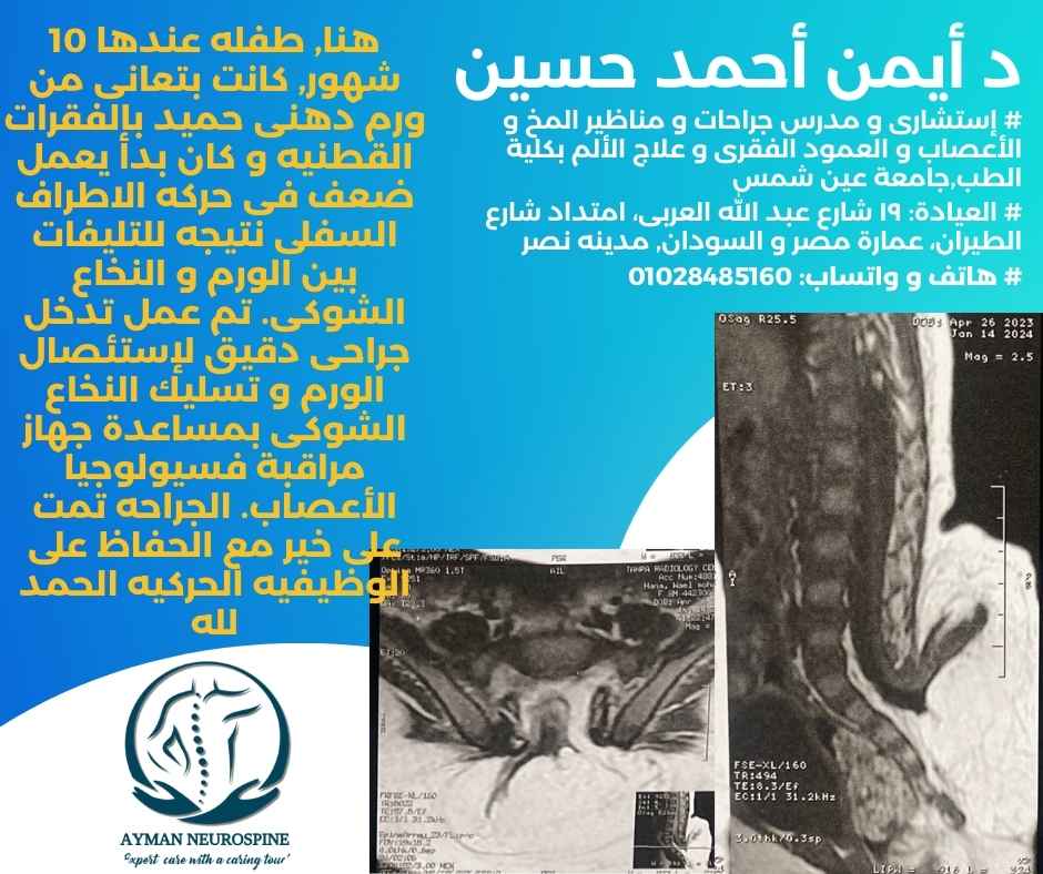 جراحة أورام العمود الفقرى