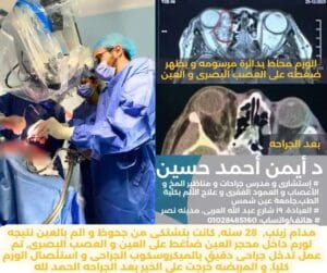 استئصال ورم بمحجر العين