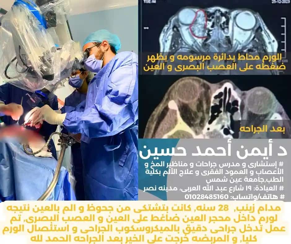 استئصال ورم بالمخ و محجر العين بالمكيروسكوب الجراحى