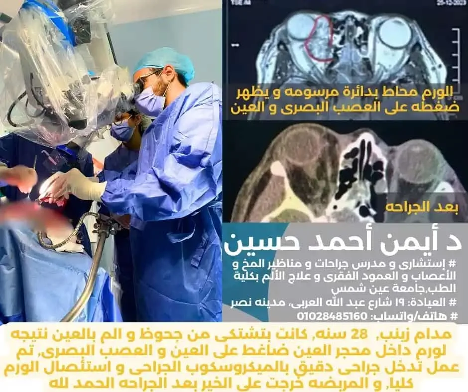 استئصال ورم بالمخ و محجر العين بالمكيروسكوب الجراحى